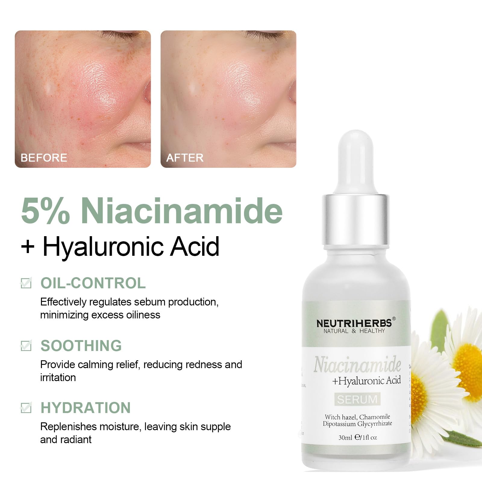 Neutriherbs 5% Niacinamide Serum for Face the Ordinary + HA,Effectively Work to Control Excess Facial Oil, Minimize the Pores and Prevent Breakouts, Best Niacinamide Serum For Oily Skin